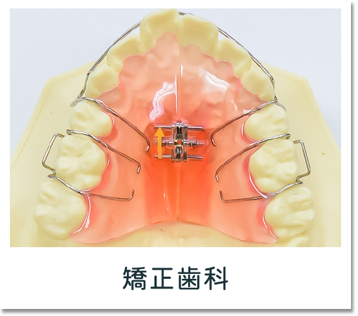 矯正歯科