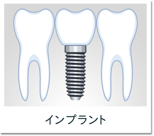 インプラント