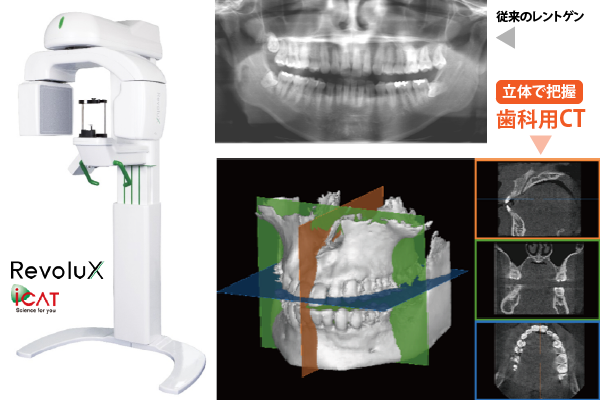 歯科用CT